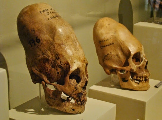 Homo Capensis: Η δολιχοκέφαλη φυλή που ελέγχει τον κόσμο?   (video)