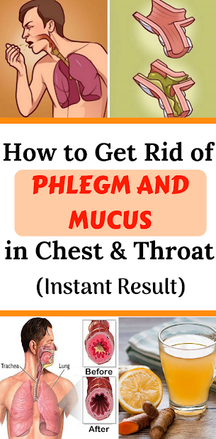 Get Rid of Mucus Buildup and Lung Problems With This Remedy