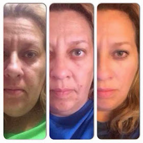 Nerium before and after 2