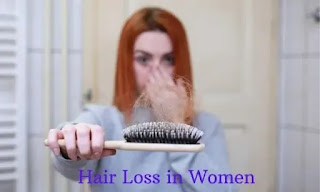 Do You Know the Top 3 Causes of Hair Loss in Women?
