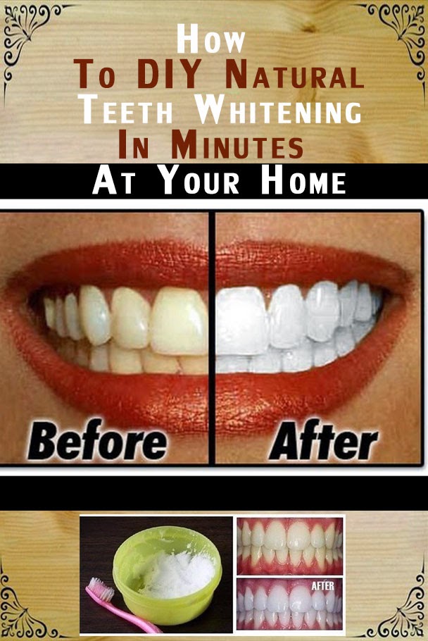 Natural Tooth  Whitening  Ideas  How to DIY Natural Teeth  