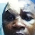Gunmen Shot Man 5 Times In The Head In Owerri, Imo State – How Engineer Anosike Cheated Death