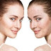 Getting Over Acne: Best Acne Scar Treatment