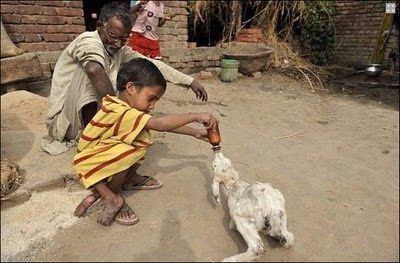 Most Unusual Indian Conjoined Twins Pictures