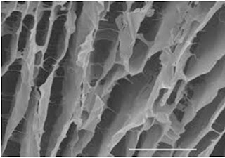 Hydrogel Scaffold: Electron Microscopic View