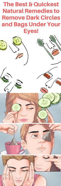 11 NATURAL CURES FOR REMOVAL OF DARK CIRCLES UNDER THE EYES