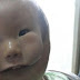 Meet China's 'mask boy': Child appears to have two faces due to rare birth defect