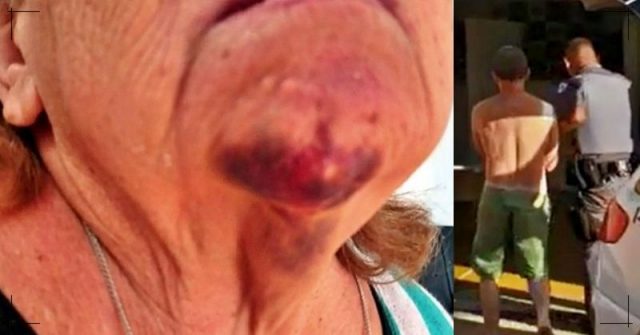 Filho agride e ateia fogo na mãe de 73 anos por estar incomodado com o ronco dela