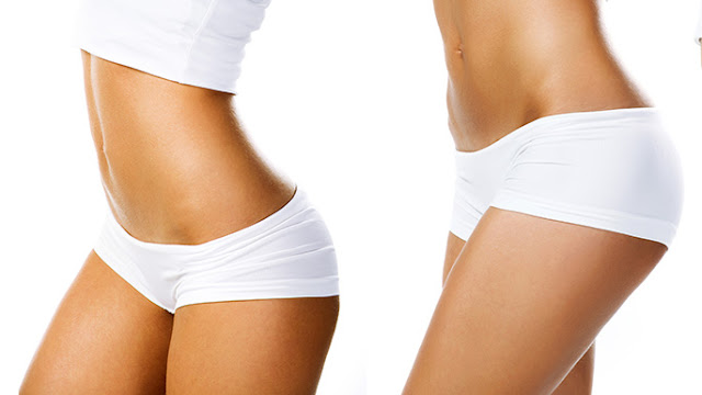 Mini tummy tuck