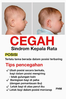 Mengapa Kepala Bayi Anda Rata?