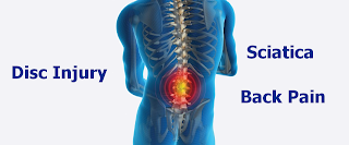 Disc Pain/ Lower Back Pain