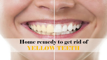 Home remedy to get rid of Yellow teeth at home
