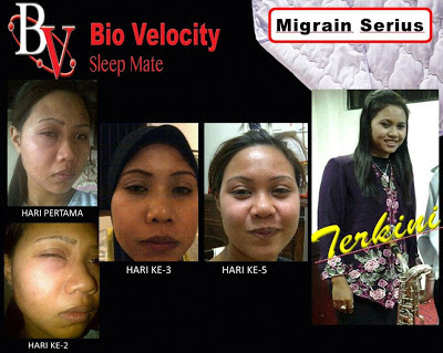 BIO VELOCITY SLEEP MATE HILANGKAN MIGRAIN