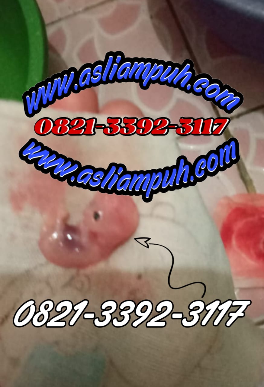 Jual Obat Aborsi Asli 0821-3392-3117 Cytotec Misoprostol 400 Mcg adalah Cara Menggugurkan Kandungan usia Janin 1,2,3,4,5,6,7,8 Bulan (Obat Penggugur Kandungan)