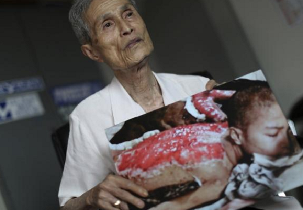 Selamat dari Bom Nagasaki, Pria ini Masih Terus Merasakan 