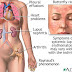 Lupus, Pertarungan Seumur Hidup