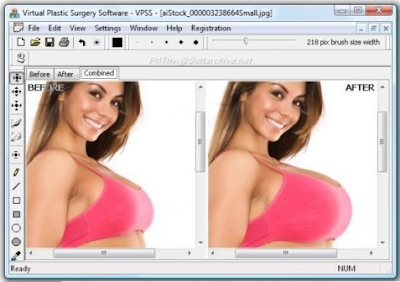 Virtual.Plastic.Surgery.Software.1.0.0.1484 ( 2010 )