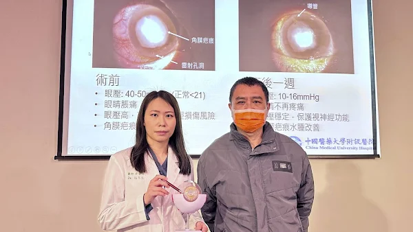 ▲中國醫藥大學附設醫院眼科醫學中心李宥伶醫師為張先生進行「青光眼導管植入術」，並輔以「眼內OCT術中斷層定位」，成功搶救惡視力。（記者林明佑翻攝）