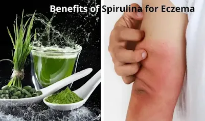 Benefits of Spirulina for Eczema