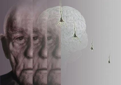 Alzheimer levetid