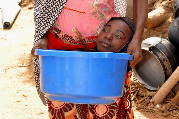 Rahmas-mother-Fadi-seen-carrying-her-in-a-bowl