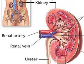 Cara Hidup Sehat Dengan 1 Ginjal