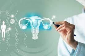 Ovarian cancer