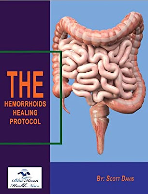 The Hemorrhoids Healing Protocol PDF Reviews eBook