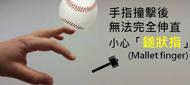 #Mallet finger #鎚狀指  #槌狀指槌#手指扭傷 #手指肌腱斷裂  #吃蘿蔔乾 #運動復健 #治療 #李嘉瑋醫師 #復健加油站