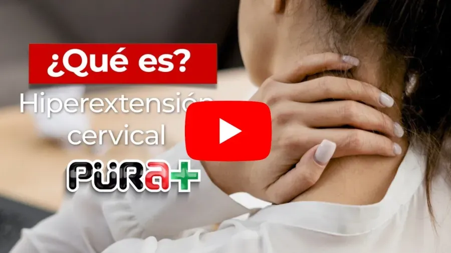 Video sobre Hipertension Cervical