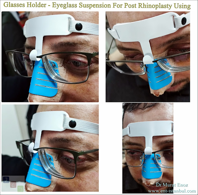 Glasses Holder - Eyeglass Suspension For Post Rhinoplasty Using