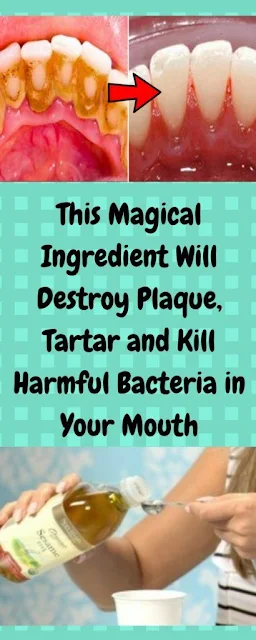 This Magical Ingredient Will Destroy Plaque, Tartar And Kill Harmful Bacteria In Your Mouth