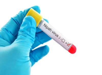 Nipah Virus