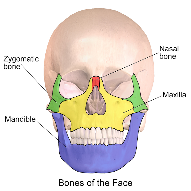 Zygomatic bone Fracture