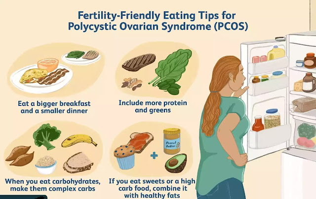 Polycystic Ovary Syndrome (PCOS): Symptoms, Causes, and Treatment