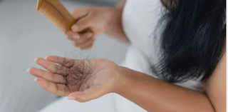 Woman experiencing hair fall while combing — hair loss treatment for women.