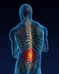 Nursing Management of Low Back Pain
