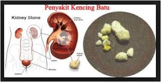 Obat Alami - Khasiat Tanaman Kumis Kucing Untuk Kesehatan Tubuh