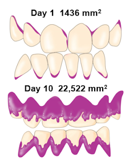 Pengertian dan Jenis flora normal, Flora normal adalah,  Residen flora adalah, Transien flora adalah, Peran Residen Flora,  Flora normal pada kulit, Flora Normal pada hidung, Flora Normal pada Orofaring (Oropharynx), Flora Normal pada saluran pernafasan, Flora Normal pada mulut, Flora normal pada mata, Flora normal pada telinga, Flora normal pada saluran pencernaan, Normal flora pada uretra, Normal flora pada vagina, penyebab komedo, penyebab jerawat , bakteri penyebab jerawat, mikroorganisme penyebab karang gigi