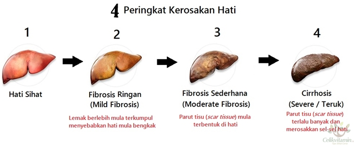 Masalah Hati Rosak