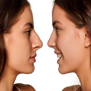 https://www.dynamiclinic.com/en-ae/cosmetic-surgery/rhinoplasty-nose-surgery/