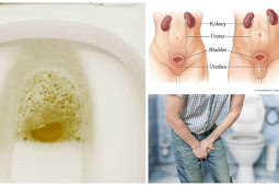 Saat Buang Air Kecil Urine Kamu Berbuih Banyak? Ketahui Alasannya Sebelum Menyesal