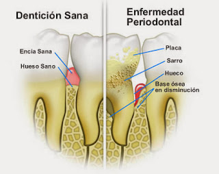 enfermedad periodontal en perros y gatos 