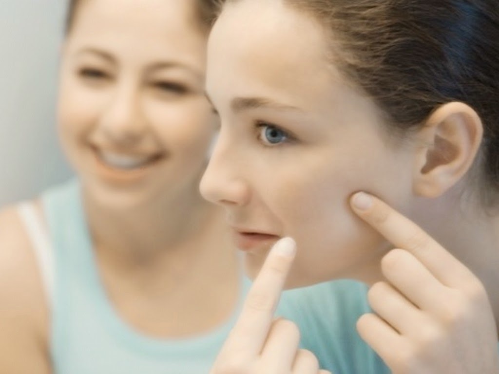 Cara Mencegah acne scar