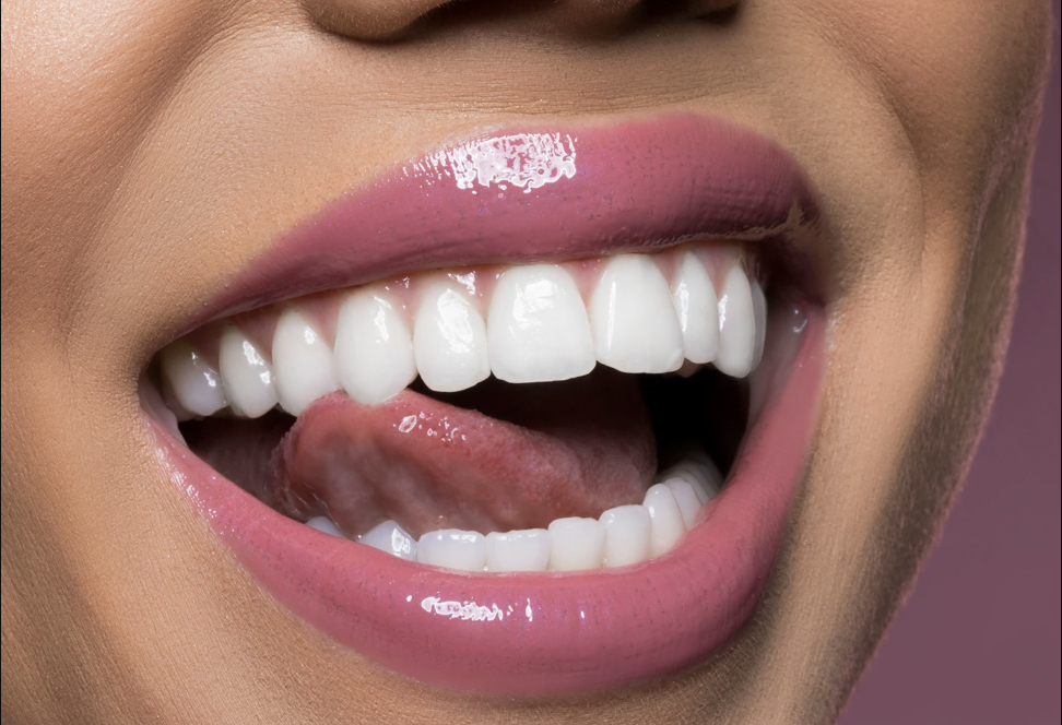 Estetik diş ve estetik diş hekimliği nedir?