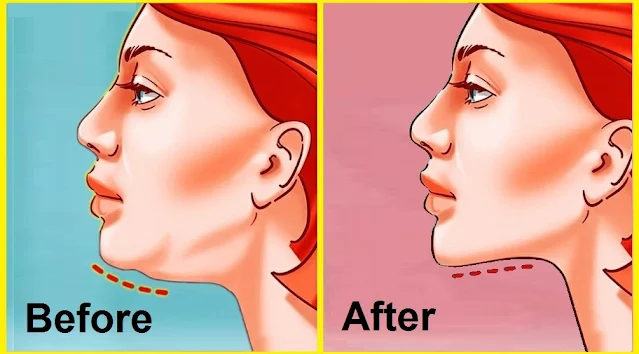 Effective Exercises To Get Rid Of Double Chin And Neck Fat