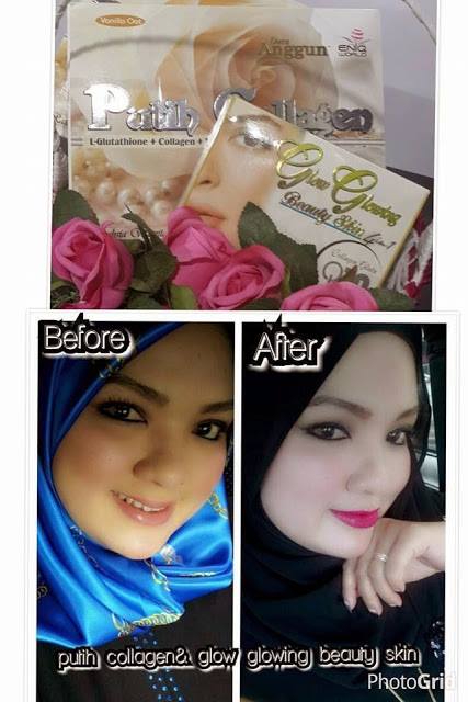 Glow Glowing Beauty Skin Skincare Murah