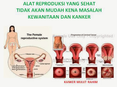 tips cara mempersempit miss V alami, tips cara mempersempit miss V herbal, tips cara mempersempit miss V mujarab, tips cara mempersempit miss V ampuh