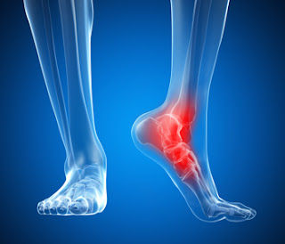 7 tratamentos das entorses de tornozelo