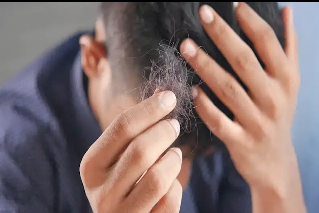 Hair Care Tips:बालों के झड़ने से हैं बेहद परेशान तो.करें ये तीन घरेलू उपाय